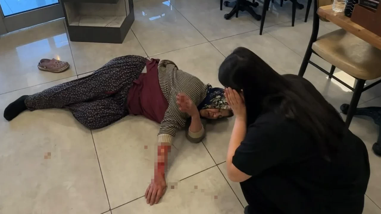 Dinlenme tesisinde dehşet: Başıboş köpekler kadının kolunu kopardı