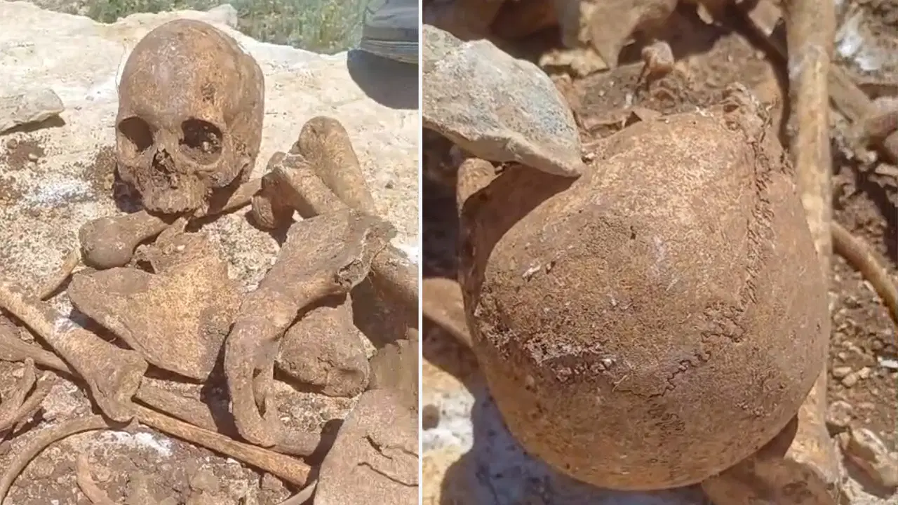 Malatya'da şaşırtan olay: İnşaat kazısında insan kemikleri bulundu