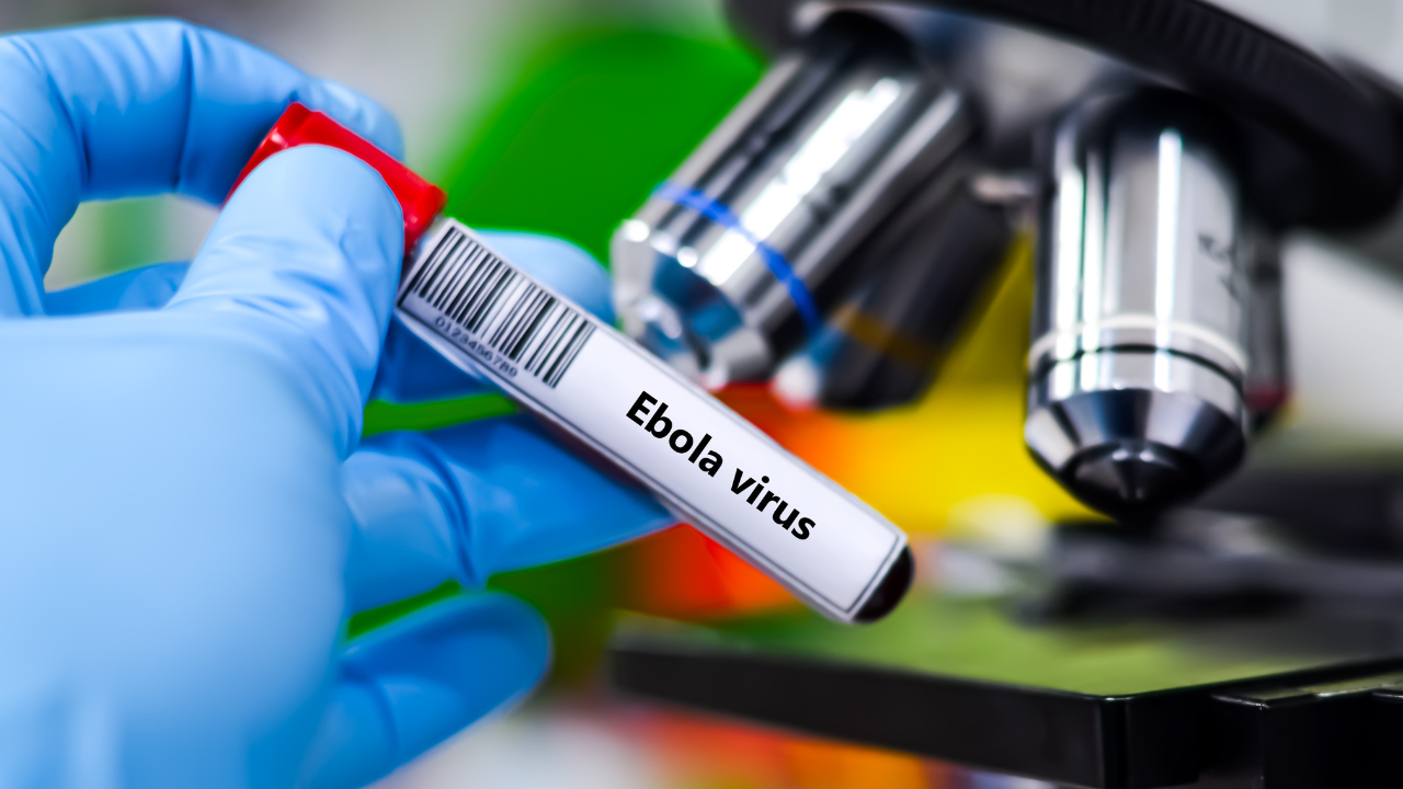 Fransa'da Ebola vakası görüldü