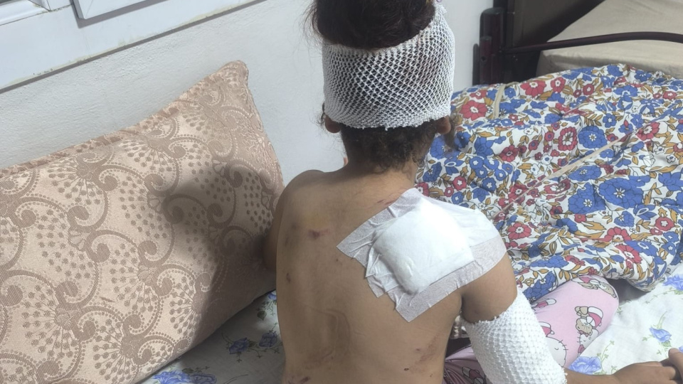 Suruç’ta başıboş köpekler 8 yaşındaki çocuğa saldırdı! 150 dikiş atıldı