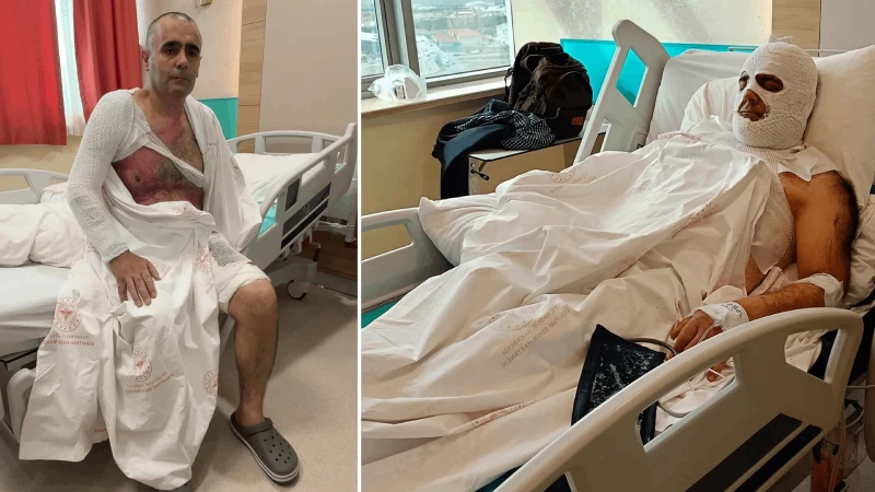 Yüksek gerilim hattı dehşeti: Dört çocuk babası ölümden döndü, 'Bana tehlikeyi söylemediler'