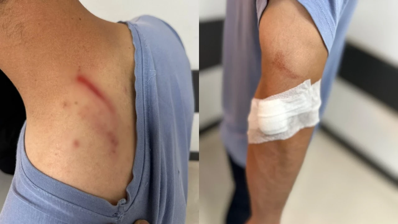 İlaç raporu tartışmasında tıbbi sekreteri darbetti