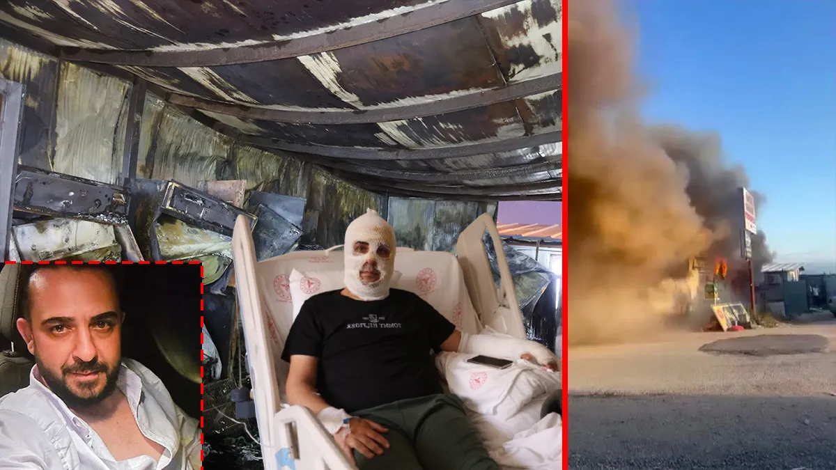 İşyerini kurtarmak için alevlerin arasına daldı! Talihsiz adam kabus dakikalarını anlattı: Can havliyle…