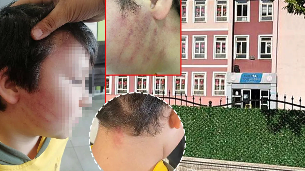 SON DAKİKA… Okulda şiddetin başrolünde bu kez veli var! 8 yaşındaki çocukları temizlik fırçası ile darp ettiler: İşte istenen ceza…