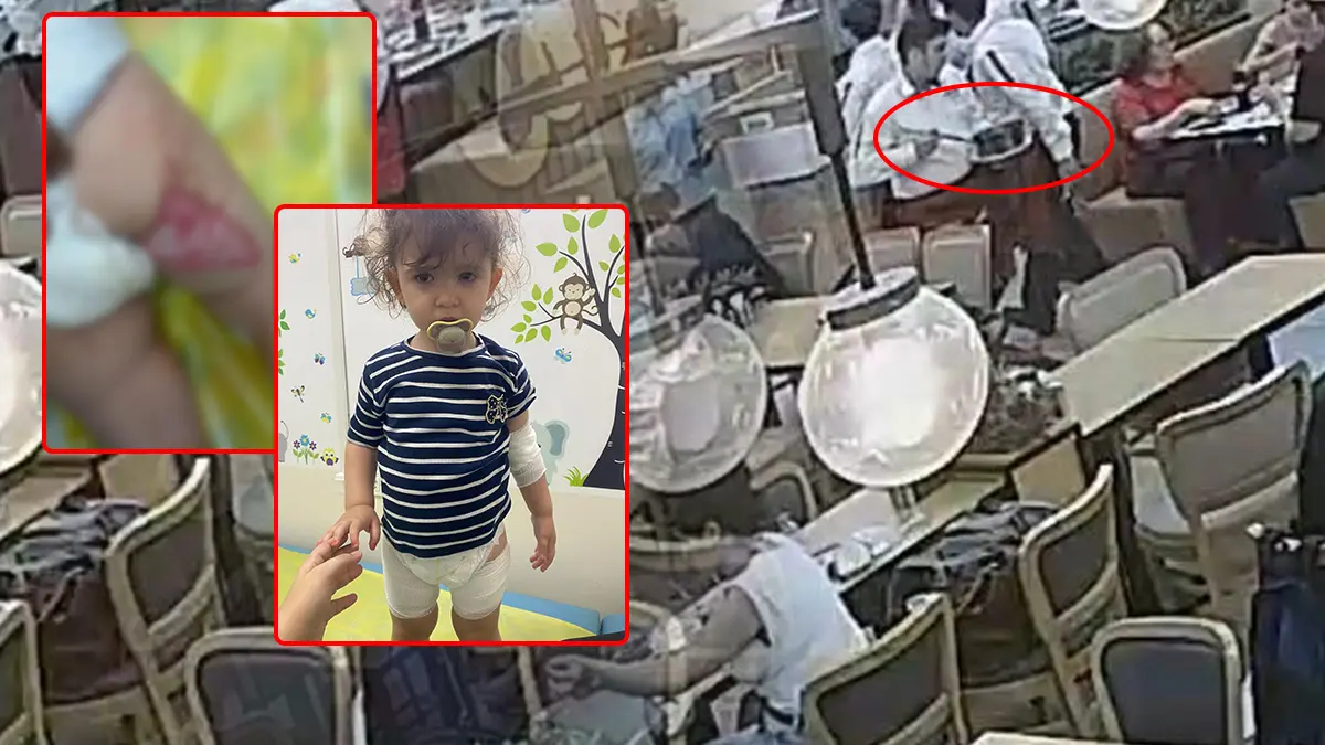 'Tereyağı şovu' faciaya dönüştü: Acı çığlıklar restoranı ayağa kaldırdı