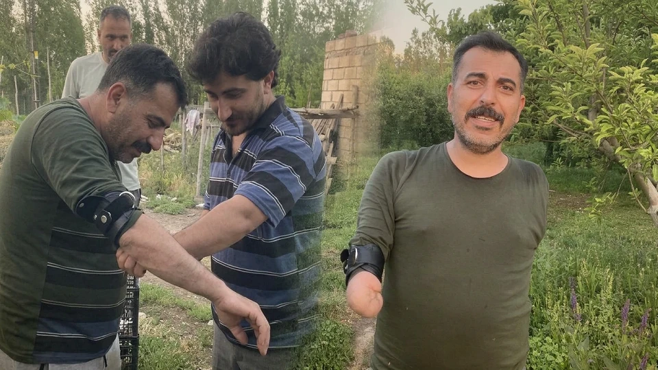 Iğdırlı Yusuf Akgün'ün azim hikayesi: İki kolunu kaybetti, KAAN'ı modelledi