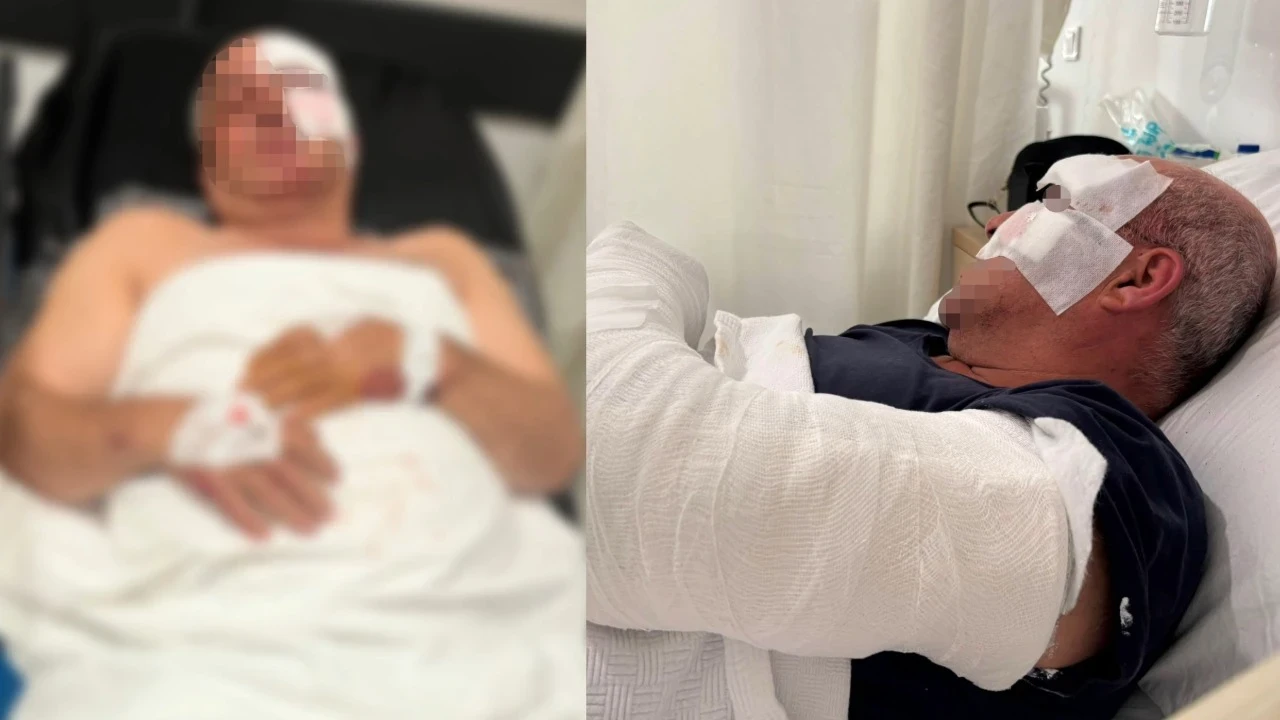 Hastaneye yaralı getirildi: Kardeşim bana bilerek çarptı
