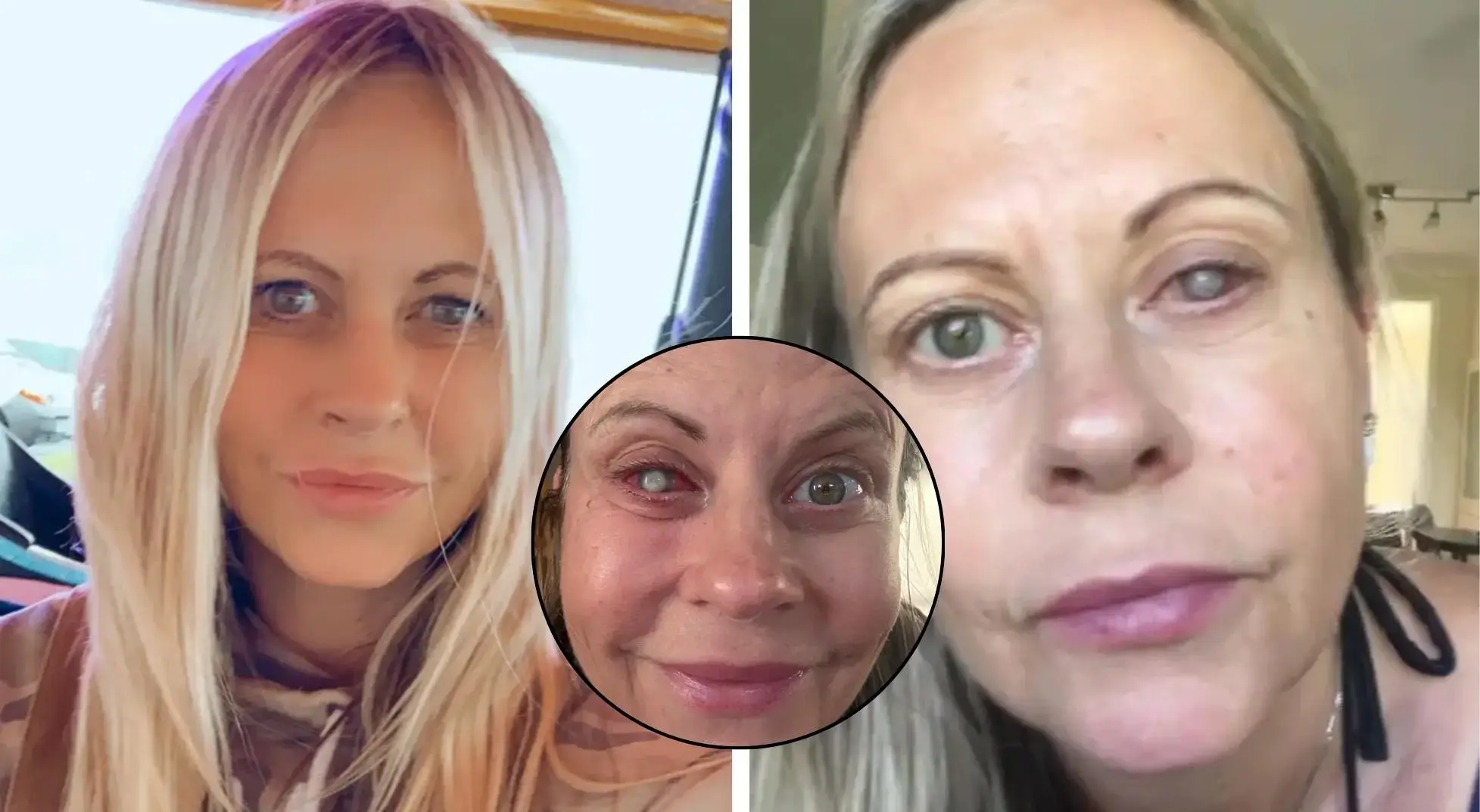 Yüzünü yıkamasıyla kabusu yaşadı! Parazit gözünü adeta yedi: 'Üç doğum bunun yanında rüya gibi kalır'