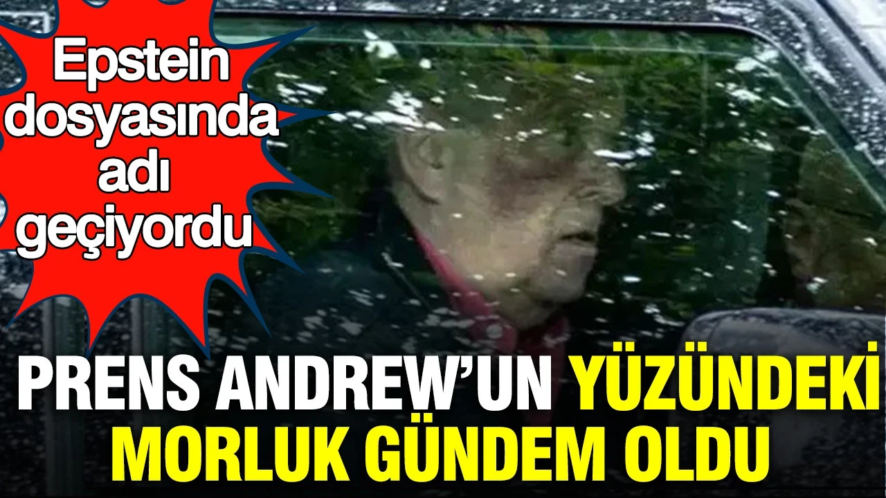 Epstein dosyasında adı geçiyordu: Prens Andrew’un yüzündeki morluk tartışma yarattı