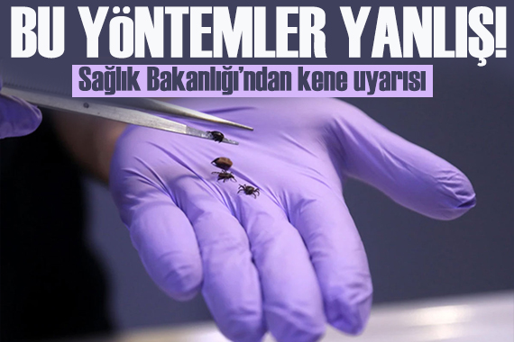 Sağlık Bakanlığı’ndan kene uyarısı! Bu yöntemleri denemeyin!