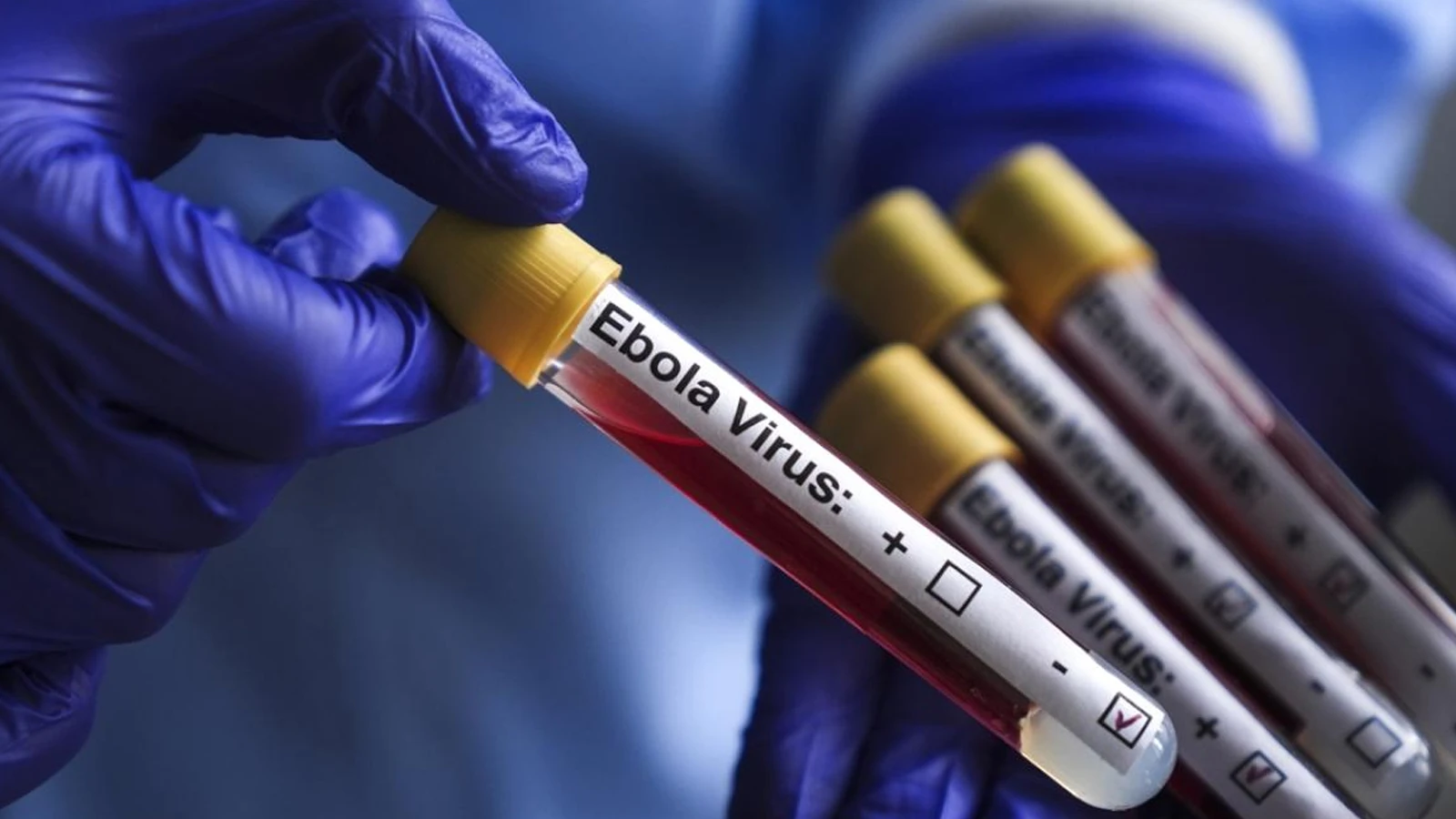 Ebola’ya karşı yeni umut: İlk deneysel aşı insanda denendi
