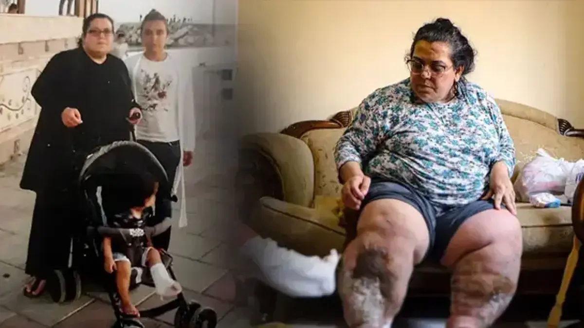 Fil hastalığıyla yaşam savaşı! 3 çocuk annesi Fatma: 'Yaralarda kurtlanma oluşuyor'