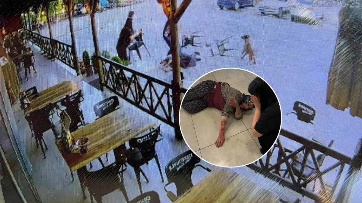 Dinlenme tesisinde can pazarı! Köpek kadının kolunu kopardı