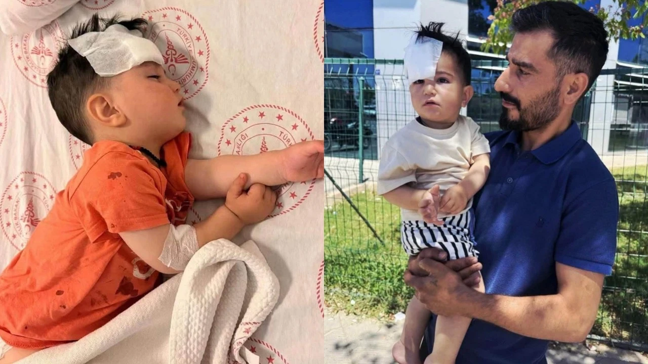 Sokak köpeğinin saldırısına uğrayan çocuk yaralandı