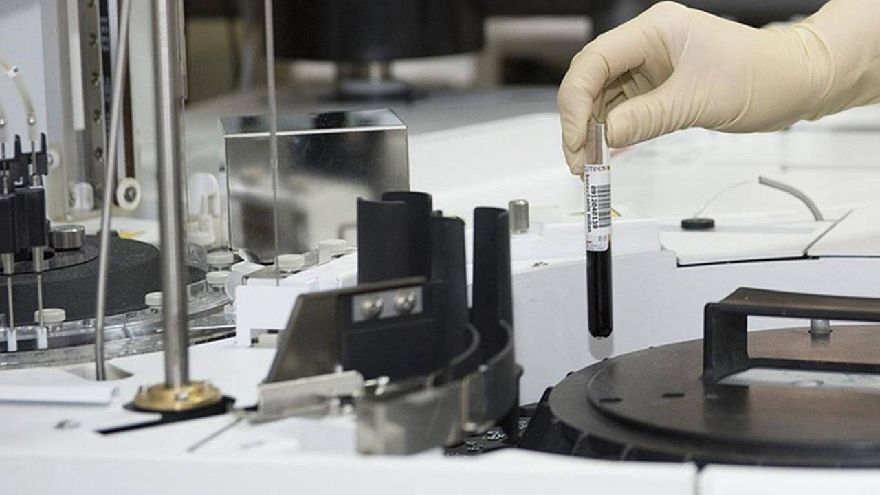 DNA analizleri ortaya koydu: Veba sanılandan çok daha eski