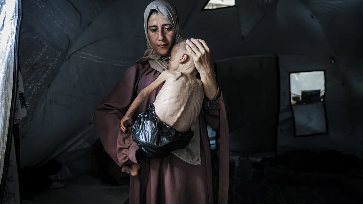 Gazze'de acı bilanço artıyor: Can kaybı 73 bin 269'a yükseldi