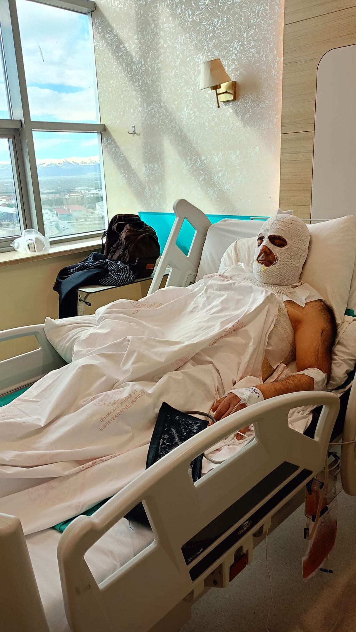Yüksek gerilim akımına kapılan işçi 42 gündür hastanede