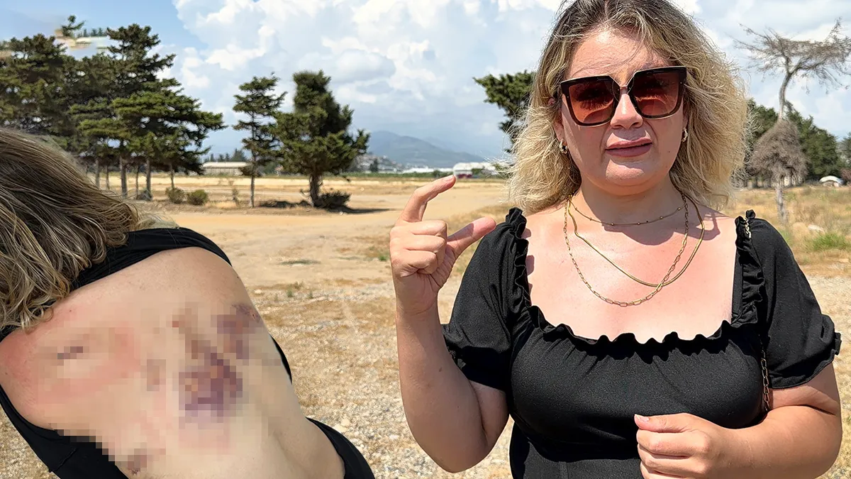Eski sevgilisi tam 30 yerinden bıçakladı! Talihsiz kadın dehşeti anlattı: Bıçak sırtımda kırılmasa…