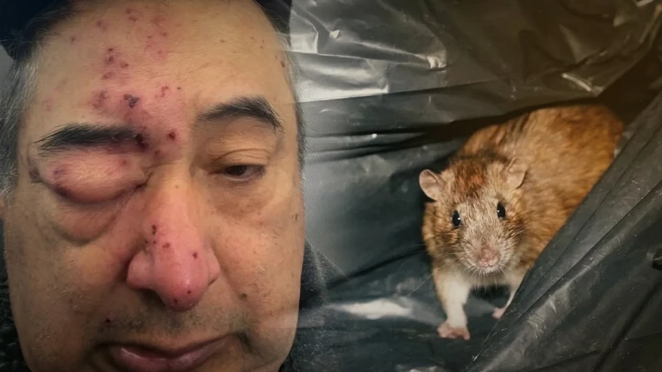 Chicago'da kan donduran olay: Yorgunluktan uyuyakalan talihsiz adamın yüzünü fareler kemirdi