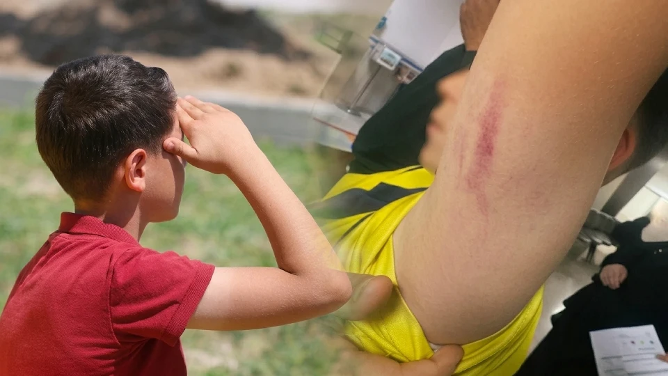 Konya'da okul parkında darp: 10 yaşındaki çocuğa saldıran veli hakkında adli işlem başlatılıyor | Güncel Haberler