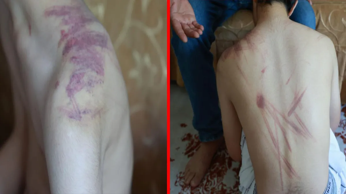 Elazığ'da kan donduran olay: 14 yaşındaki engelli çocuğa şiddet… Acılı baba soluğu adliyede aldı