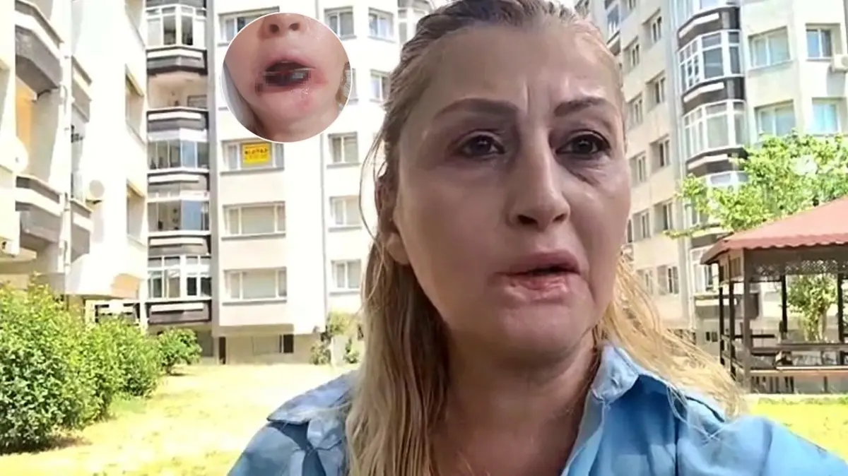 Antalya'da estetik faciası: Hayatımı hiçe saydılar